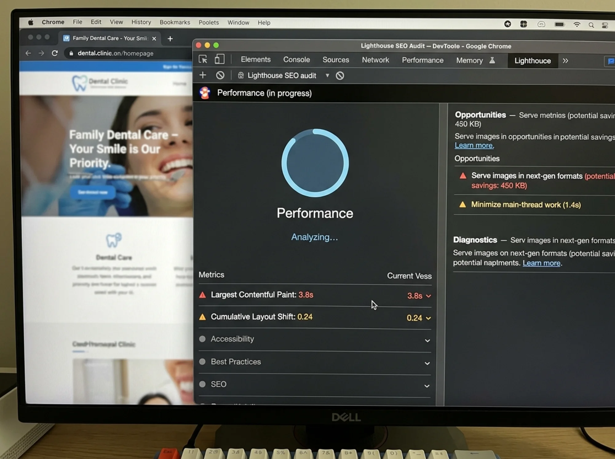 Close-up of a browser with Chrome DevTools open on the Lighthouse panel mid-audit for a small dental clinic homepage, showing a Performance score circle filling in and a sidebar listing "Largest Contentful Paint 3.8s" and "Cumulative Layout Shift 0.24" with red and amber indicators